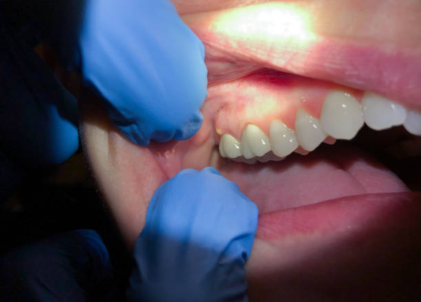 Best Cracked Tooth Emergency Dentist  in White Sulphur Springs, MT