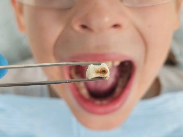 Dentist for Dental Trauma in MT